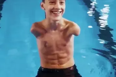 Garoto sem os dois braços está dentro de uma piscina, usando calção preto, e sorri para a câmera.